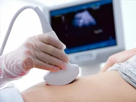 Doppler obstétrico